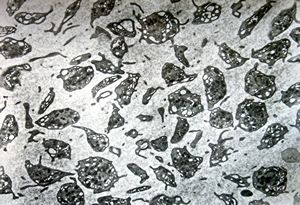 blood - trombocytes blood - trombocytes